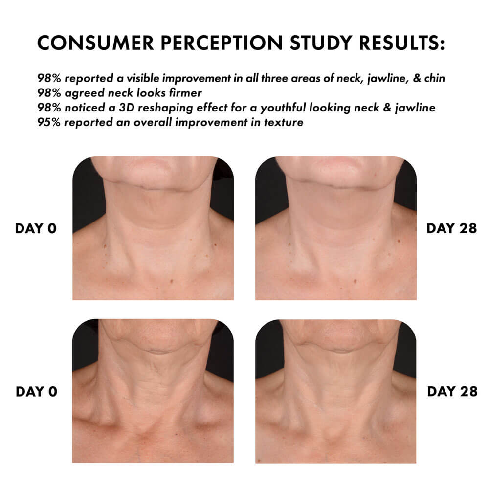 whish beauty Neck Firming Complex with Bakuchiol