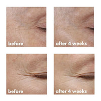 whishbeauty Skin Care > Eye Treatment Revitalizing Eye Cream with Bakuchiol - New and Improved!