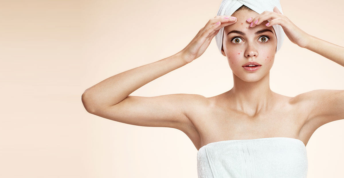What Your Teen Needs to Know About Teen Skin, According to Experts