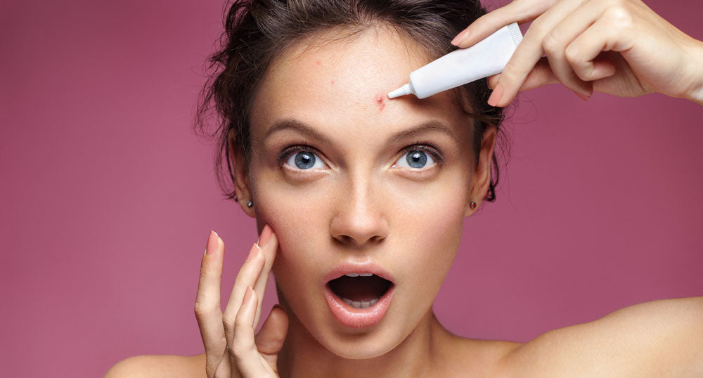 Unknown Skincare Habits That Can Worsen Acne