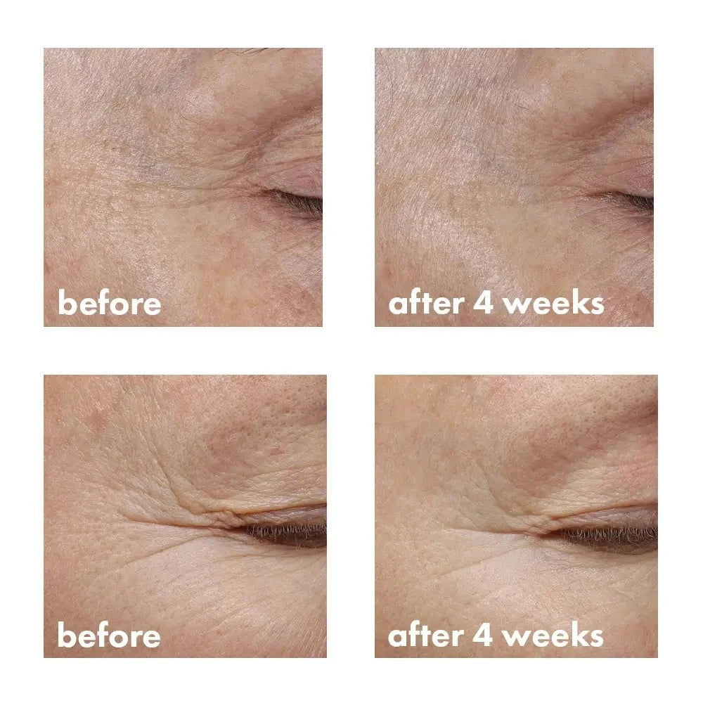 whishbeauty Skin Care > Eye Treatment Revitalizing Eye Cream with Bakuchiol - New and Improved!