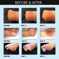 whish beauty Body Care > Exfoliators > Foot Mask Coconut Milk + Verbena Exfoliating Foot Mask